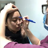 武汉爱思特杨水斌隆鼻专业吗？分享杨水斌隆鼻术前术后案例效果对比图！