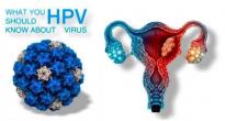 20几岁感染HPV要冷静 看完这篇文章再想办法