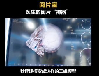 华为12月3日将发布“阅片宝”智能医疗影像系统 由华为和维卓致远合作打造