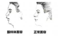 过敏性鼻炎高发季来袭 天津新世纪妇儿医院提醒科学防治很重要